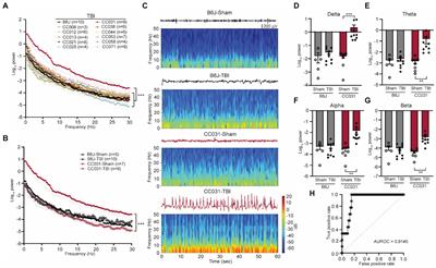 Early hippocampal high-amplitude rhythmic spikes predict post-traumatic epilepsy in mice